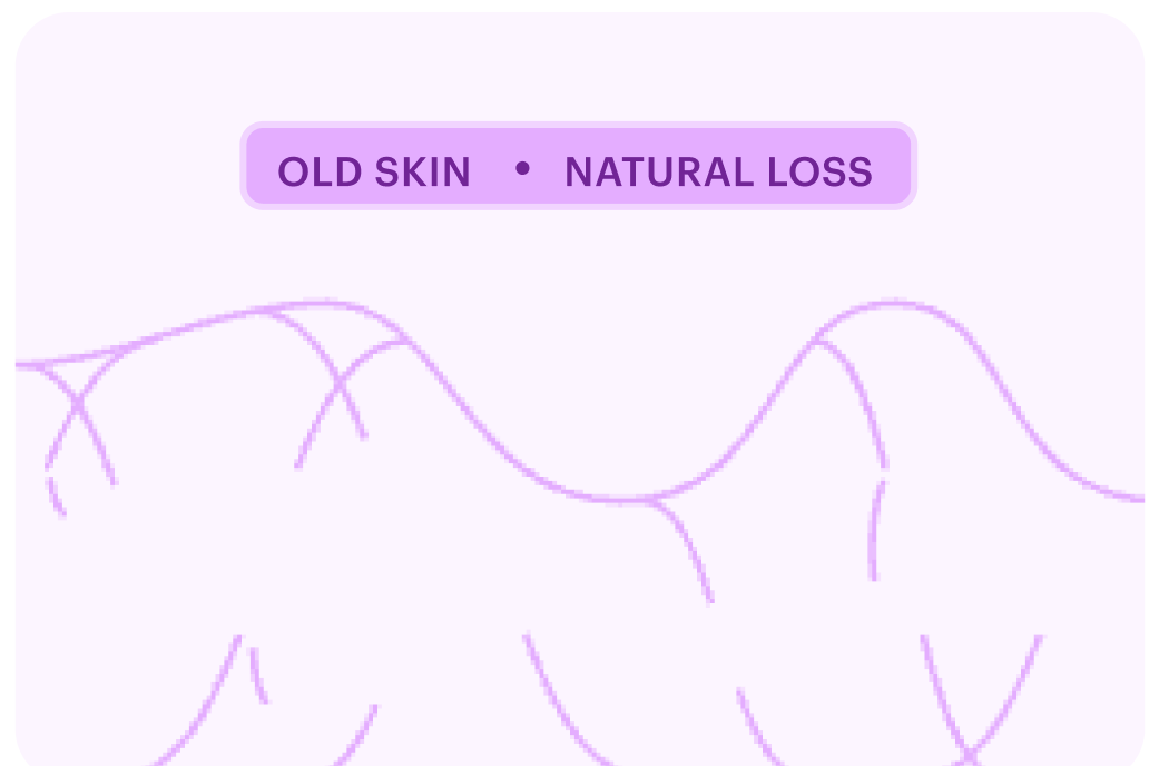 Old skin natural loss botox